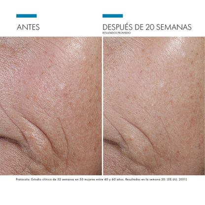 Caso clínico con C E Ferulic de SkinCeuticals: antes y después