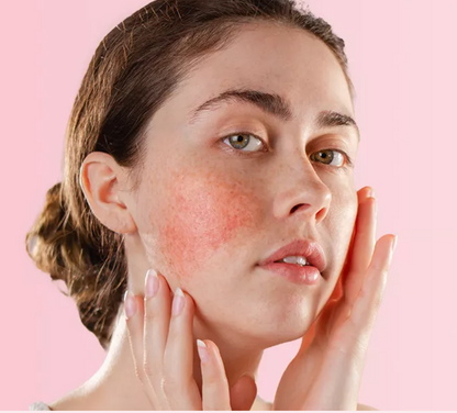 Ruboril Cleansing balm 100ml (Bálsamo limpiador calmante). Desmaquilla sin fricción, nutre y reconforta.