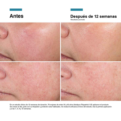 Segundo caso clínico documentado con Advanced RGN-6 de SkinCeuticals